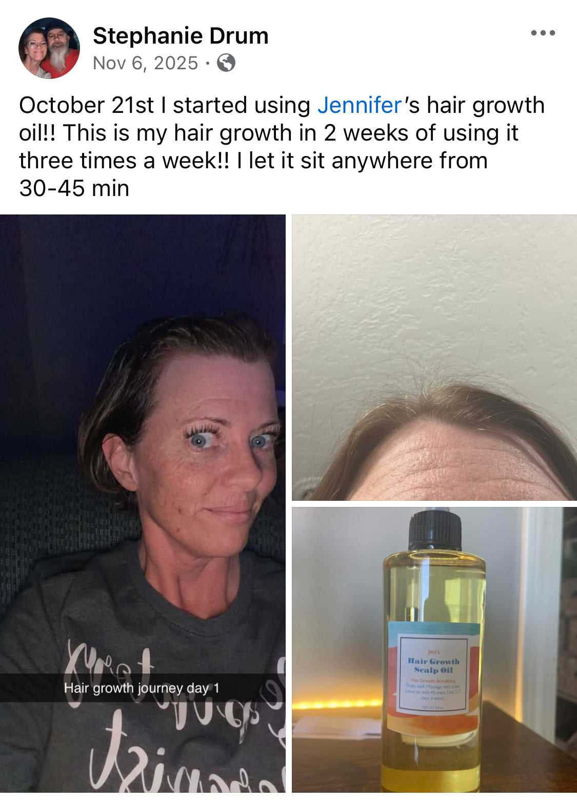 Product review post with images of a woman, hair growth oil, and text about using the product.