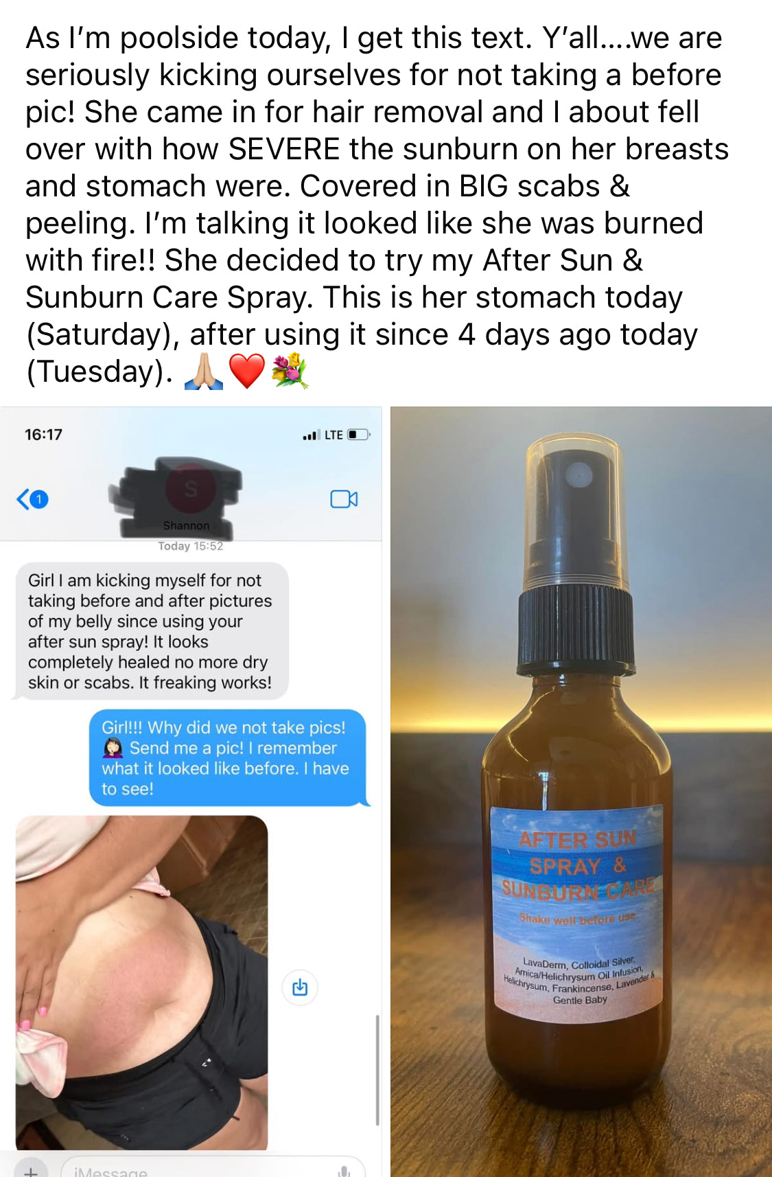 Bottle of After Sun & Sunburn Care Spray with text and before/after images on a phone screen.